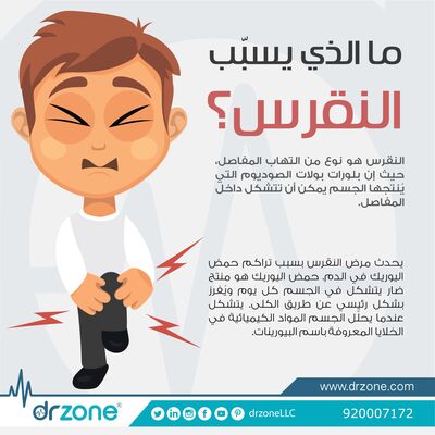 اسباب الاصابه بالنقرس